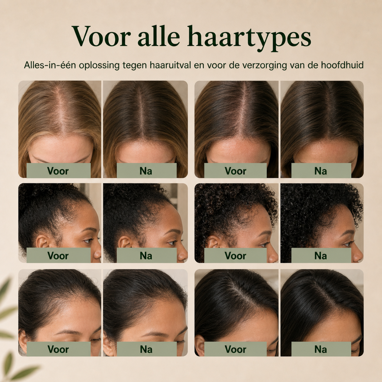 Mellando RootRevive | Een serum met ingebouwde haarborstel