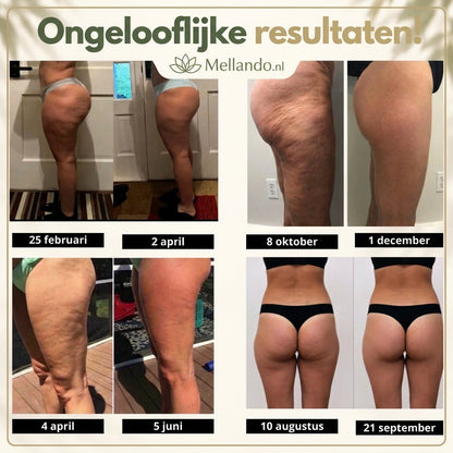 Mellando SculptFit l Vormgevende Compressielegging
