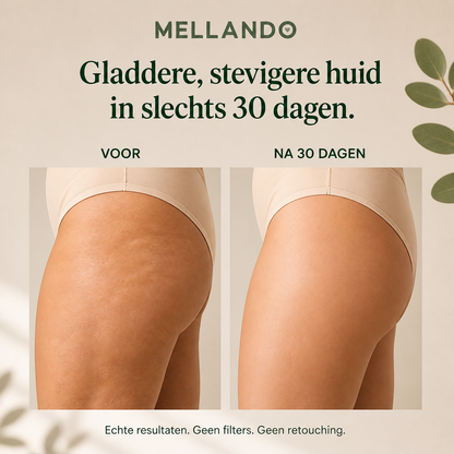 Mellando Sculpting Device l Spiermassageroller